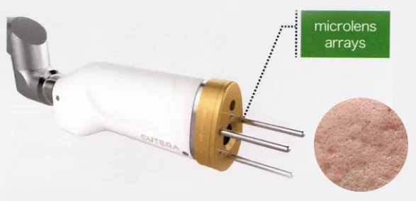 エンライトンMLA